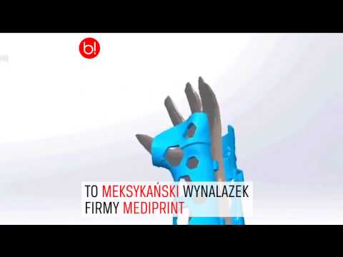 Koślawego przystanek deformacja kar Rosnąca kość w stopie na kciuku, że robią