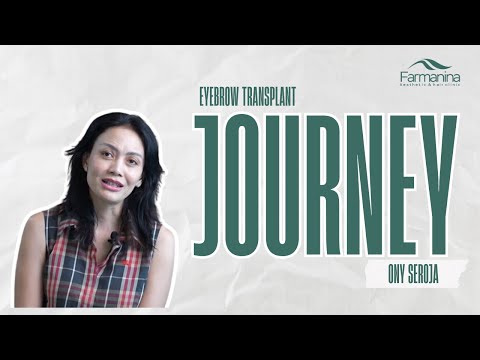 Eyebrow transplant ony Seroja