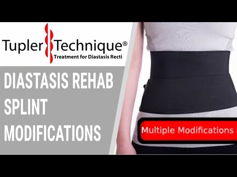 Diastasis Rehab Splint Modifications Julie Tupler,RN