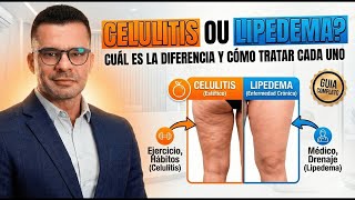 Celulitis o lipedema: cuál es la diferencia y cómo tratar cada uno.