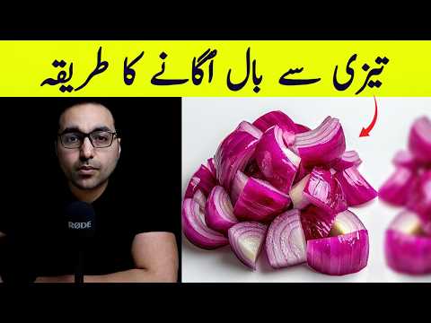 Sirf 1 pyaaz aap ke baal wapas la sakta hai | Onion Juice for Hair Growth: Stop Hair Loss - Dr. Zee