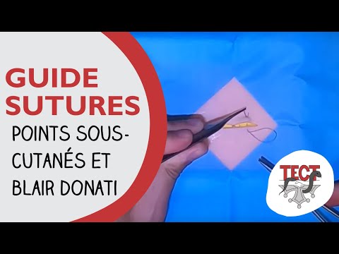 Guide suture | Points sous-cutanés et Blair Donati