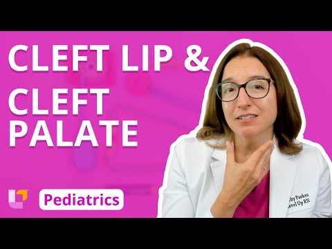 Cleft Lip & Cleft Palate: Pediatrics  - Alterations in Health | @LevelUpRN