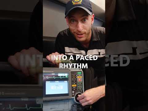 Pacing a Complete Heart Block