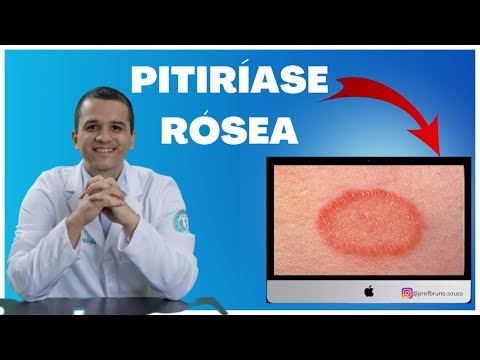 Pityriasis rosea - What it is and how to treat it.