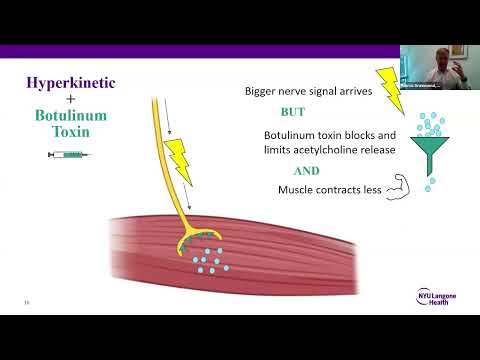 Botulinum Toxin (Botox) Treatment for Movement Disorders