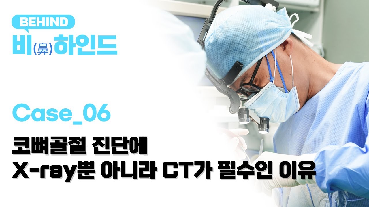 Case 06_코뼈골절 진단에 X-ray뿐 아니라 CT가 필수인 이유(비하인드)