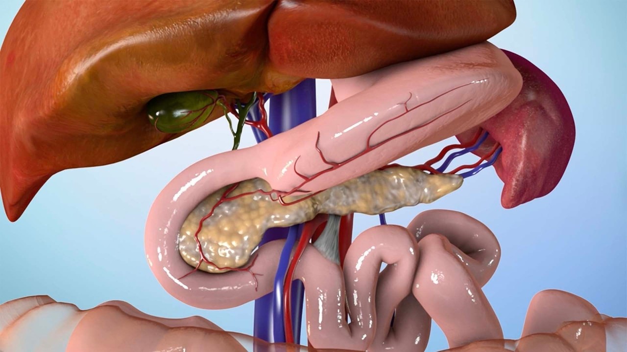 Surgery to Relieve the Pain of an Inflamed Pancreas (Pancreatitis)