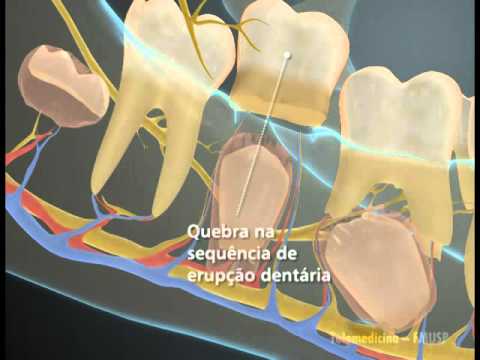 Saúde Bucal - Desenvolvimento dos Dentes