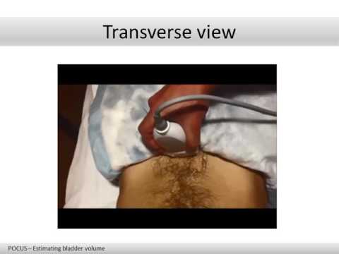 POCUS   Bladder