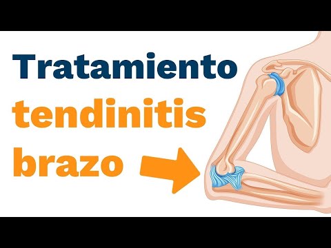 How to treat tendinitis in the arm?