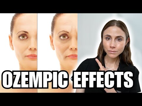 Ozempic Face? The Truth About GLP 1 Skin and Hair Side Effects