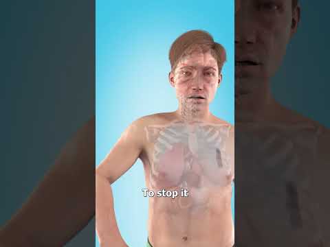 What To Do If You Puncture A Lung 🤔