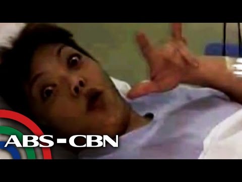 Wastong Nutrisyon pagbaba ng timbang ng calories Nangayayat Oksana Marchenko