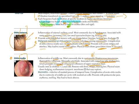 USMLE - ENT - Otology  (USMLE Step 1)