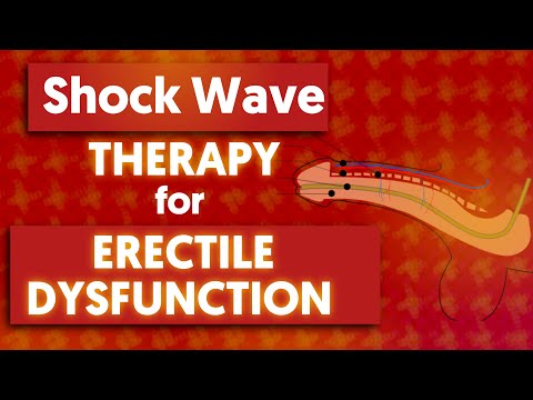Shockwave Therapy For Erectile Dysfunction