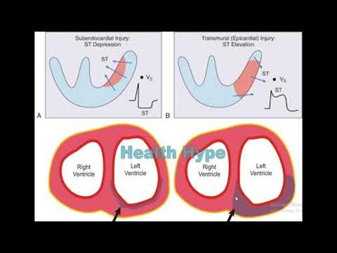 ISCHEMIC HEART DISEASES PART - 1