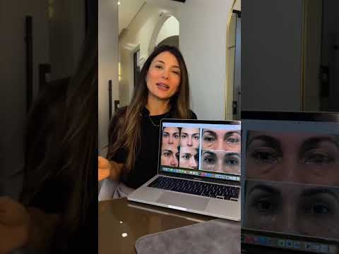 video aybYEl550yY