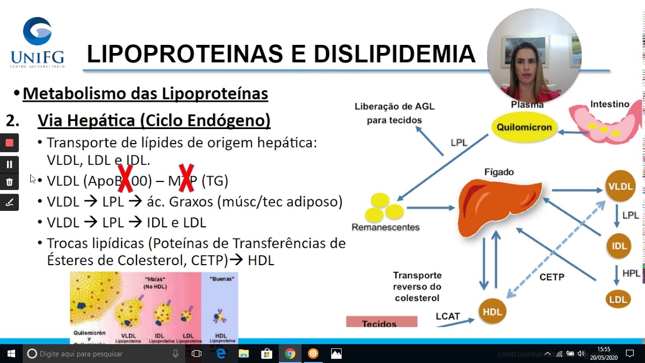 Lipoproteínas e Dislipidemia