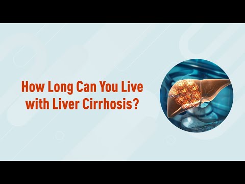 How Long Can You Live with Liver Cirrhosis?