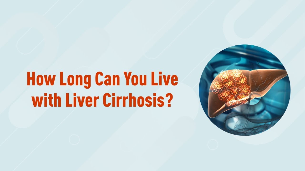 How long can you live with ascites with cirrhosis? Tipseri