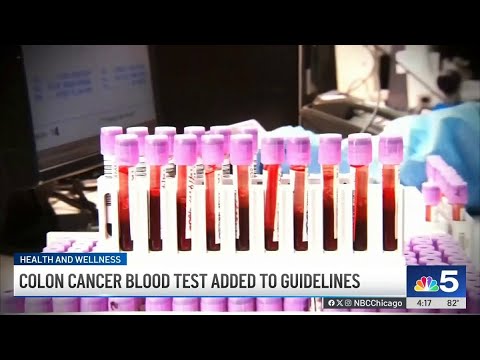 Blood test added to colon cancer screening guidelines