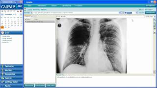 preview picture of video 'Tutorial Software GalenusPro - Consulta e historial'