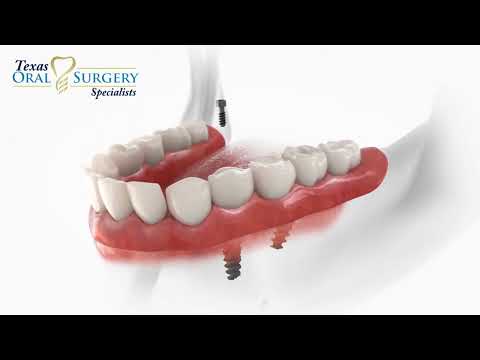 Dr. Chris L. Tye, MD, DDS YouTube video thumbnail 10