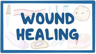 Wound Healing