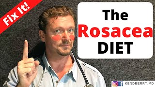 ROSACEA diet (Reverse the Redness) 2024