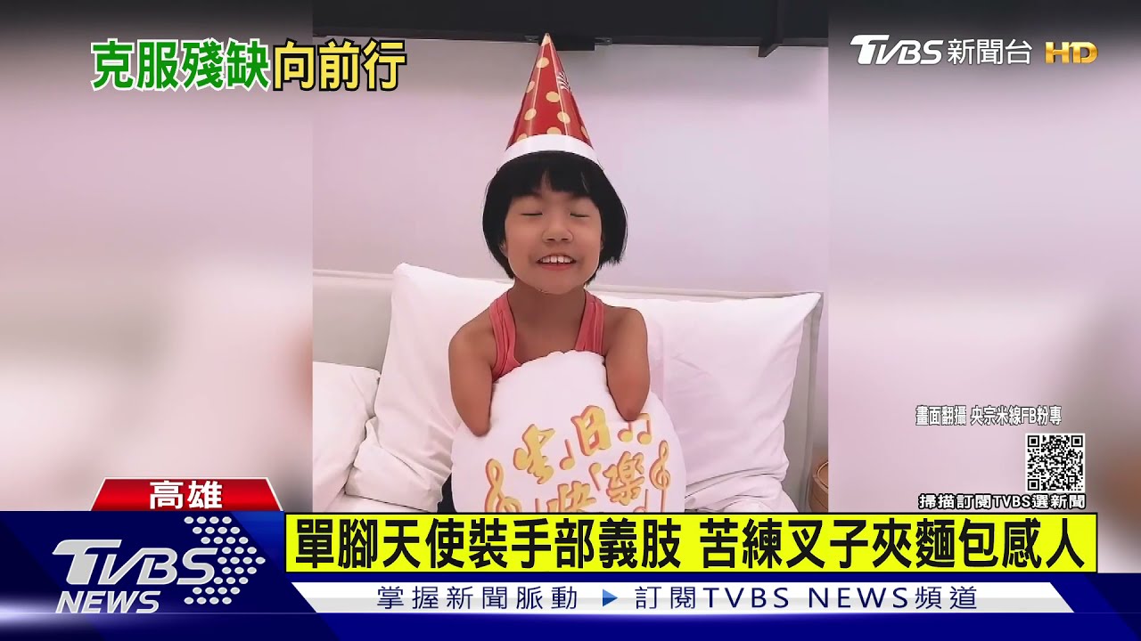 單腳天使裝手部義肢 苦練叉子夾麵包 感人