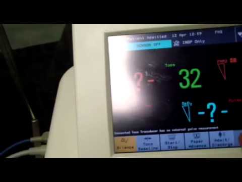 Philips M2703A Avalon FM-30 Fetal Monitor