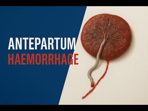 Antepartum Hemorrhage Demystified: Placenta Previa & Abruptio Placentae🎙️