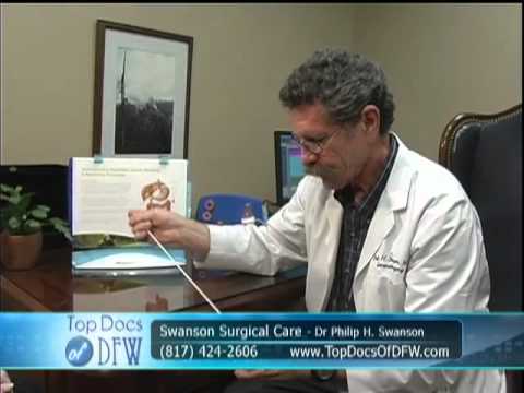 Dr. Philip Swanson Laparoscopic Gastric Binding 2 Top Docs of DFW