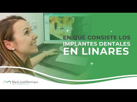 Implantología Oral Explicada por la Dra. María José Manrique | Dentista en Linares