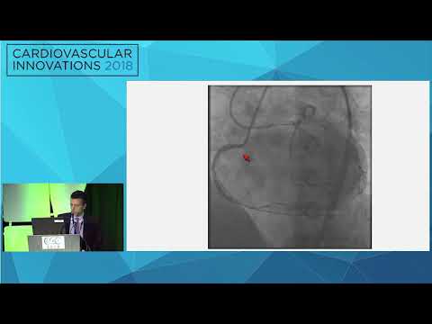 CVI2018 Session: Microcatheter entrapment - Wissam Jaber, MD