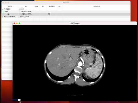 保健学科 PHORLIX Ver0.0.5 2D Viewer