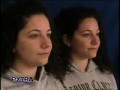 Extreme Rhinoplasty Results on Twins -Extra TV with Dr. Ashkan Ghavami