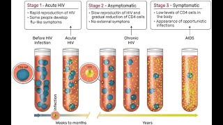 Bidirectional relationship betwern Opportunistic infections and HIV & AIDs