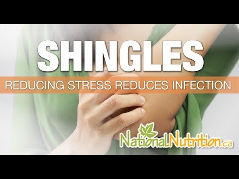 Shingles: A Guide To Managing Symptoms
