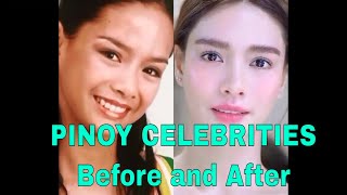 PINOY CELEBRITY (BEFORE AND AFTER) video
