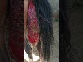 Utrine Prolapse In Mare