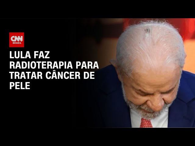 Lula faz primeira sessão de radioterapia para tratar câncer de pele | CNN 360°