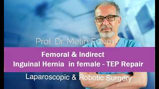 Miniaturka - Femoral & Indirect inguinal hernia in female. TEP Repair. Metin Ertem MD FACS.