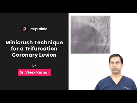 Minicrush Technique for a Trifurcation Coronary Lesion | Dr. Vivek Kumar | Medicine PrepClinic