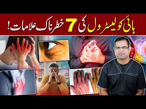 Cholesterol Warning: 7 Dangerous Symptoms You Must Know!