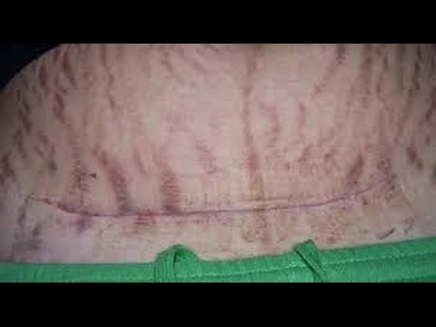 Yang minum minyak diet jarak Resensi film pelangsing perut sauna