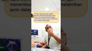 Download lagu Operasi sesar itu dijahit engga sih? Katanya di lem 😅? Trus nembus perut itu gimana sih prosesnya? mp3