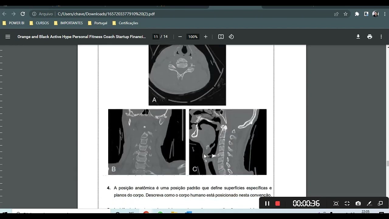Atividade Pratica -Anatomia das Imagens (COMPLETO) #atividadepratica #anatomiadasimagens #radiologia