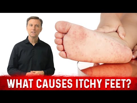 What Causes Itchy Feet and How to Stop It? – Dr. Berg